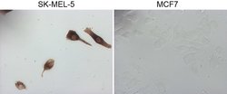 MLANA Monoclonal Antibody (OTI2E7), TrueMAB , OriGene:Antibodies:Primary