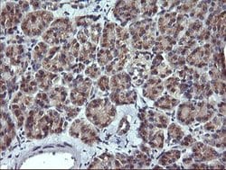 MLANA Mouse anti-Human, Clone: OTI3E2, lyophilized, TrueMAB 100 &mu;g;