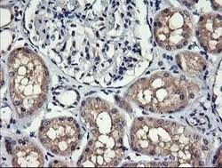 MLANA Mouse anti-Human, Clone: OTI3E2, lyophilized, TrueMAB 100 &mu;g;