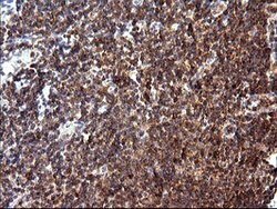 MLANA Monoclonal Antibody (OTI2G2), TrueMAB , OriGene 100 &mu;L; Unconjugated:Antibodies,