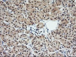 MLANA Monoclonal Antibody (OTI1F12), TrueMAB , OriGene 100 &mu;L; Unconjugated:Antibodies,
