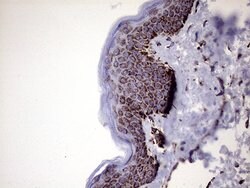MLANA Monoclonal Antibody (OTI6G3), TrueMAB , OriGene 100 &mu;L; Unconjugated:Antibodies,