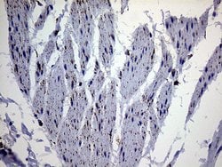 MLANA Monoclonal Antibody (OTI6G3), TrueMAB , OriGene:Antibodies:Primary
