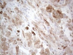 MLANA Mouse anti-Human, Clone: OTI6B12, lyophilized, TrueMAB 100 &mu;g;