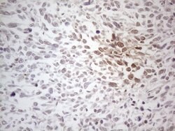 MLANA Monoclonal Antibody (OTI4F12), TrueMAB , OriGene 100 &mu;L | Buy Online | Origene Technologies | Fisher Scientific