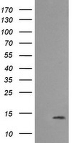 MLANA Monoclonal Antibody (OTI3A2), TrueMAB , OriGene 100 &mu;L; Unconjugated:Antibodies,
