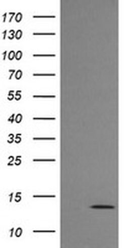 MLANA Monoclonal Antibody (OTI5E6), TrueMAB , OriGene:Antibodies:Primary