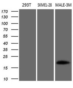 MLANA Monoclonal Antibody (OTI3G1), TrueMAB , OriGene 100 &mu;L; Unconjugated:Antibodies,