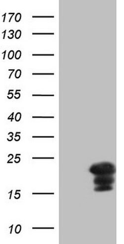 MLANA Monoclonal Antibody (OTI2D6), TrueMAB , OriGene 30 &mu;L | Buy Online | Origene Technologies | Fisher Scientific