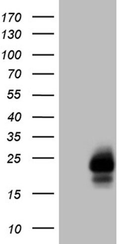 MLANA Monoclonal Antibody (OTI6G3), TrueMAB , OriGene 100 &mu;L; Unconjugated:Antibodies,