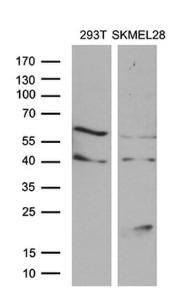 MLANA Monoclonal Antibody (OTI6G3), TrueMAB , OriGene:Antibodies:Primary