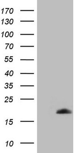 MLANA Monoclonal Antibody (OTI4F12), TrueMAB , OriGene 100 &mu;L | Buy Online | Origene Technologies | Fisher Scientific
