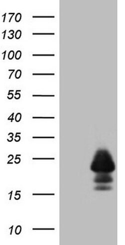 MLANA Monoclonal Antibody (OTI2E7), TrueMAB , OriGene 100 &mu;L; Unconjugated:Antibodies,