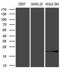 MLANA Monoclonal Antibody (OTI2E7), TrueMAB , OriGene:Antibodies:Primary
