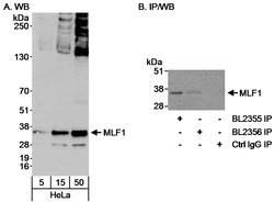 MLF1 Rabbit anti-Human, Polyclonal, Bethyl Laboratories 100 &mu;L; Unconjugated:Antibodies,