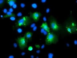 MLF1 Monoclonal Antibody (OTI2H10), TrueMAB , OriGene:Antibodies:Primary