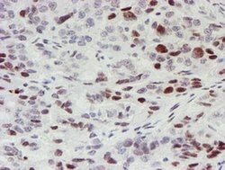 MLF1 Mouse anti-Human, Clone: OTI5D9, TrueMAB , Origene 30 &mu;L | Buy Online | Origene Technologies | Fisher Scientific