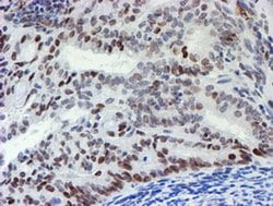 MLF1 Mouse anti-Human, Clone: OTI5D9, TrueMAB , Origene 30 &mu;L | Buy Online | Origene Technologies | Fisher Scientific