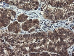MLF1 Monoclonal Antibody (OTI2D6), TrueMAB , OriGene 30 &mu;L; Unconjugated:Antibodies,