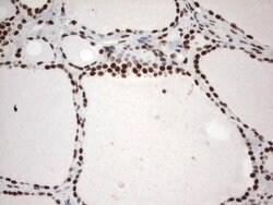 MLF1 Mouse anti-Human, Clone: UMAB138, lyophilized, UltraMAB 100 &mu;g;