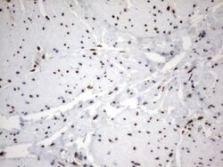 MLF1 Mouse anti-Human, Clone: UMAB138, lyophilized, UltraMAB 100 &mu;g;