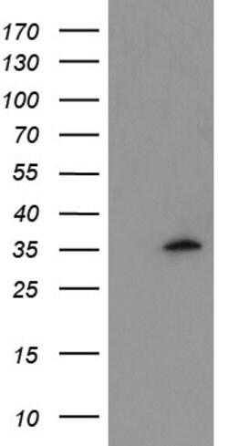 MLF1 Mouse anti-Human, Clone: OTI3F11, lyophilized, TrueMAB 100 &mu;g;