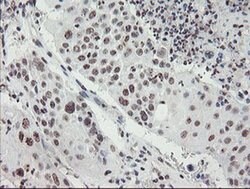MLF2 Monoclonal Antibody (OTI1E3), TrueMAB , OriGene 100 &mu;L; Unconjugated:Antibodies,
