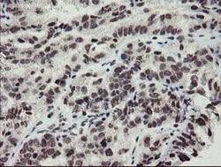 MLF2 Monoclonal Antibody (OTI1E3), TrueMAB , OriGene 100 &mu;L; Unconjugated:Antibodies,