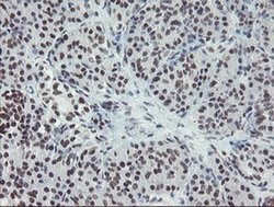 MLF2 Monoclonal Antibody (OTI1E3), TrueMAB , OriGene:Antibodies:Primary