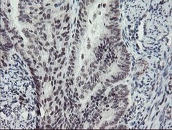 MLF2 Monoclonal Antibody (OTI1E3), TrueMAB , OriGene:Antibodies:Primary