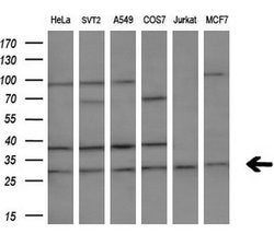 MLF2 Monoclonal Antibody (OTI1E3), TrueMAB , OriGene 100 &mu;L; Unconjugated:Antibodies,