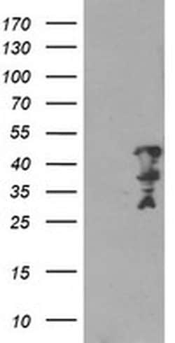 MLF2 Monoclonal Antibody (OTI1C4), TrueMAB , OriGene:Antibodies:Primary