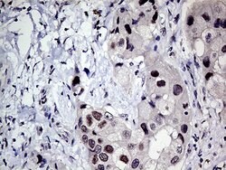 MLH1 Monoclonal Antibody (OTI4H6), TrueMAB , OriGene 100 &mu;L; Unconjugated:Antibodies,