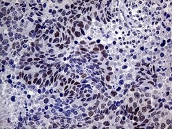 MLH1 Monoclonal Antibody (OTI3C1), TrueMAB , OriGene:Antibodies:Primary