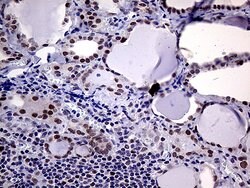 MLH1 Monoclonal Antibody (OTI3C1), TrueMAB , OriGene 100 &mu;L; Unconjugated:Antibodies,