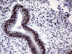 MLH1 Monoclonal Antibody (OTI3C1), TrueMAB , OriGene 100 &mu;L; Unconjugated:Antibodies,