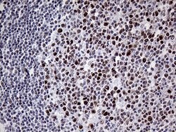 MLH1 Monoclonal Antibody (OTI3C1), TrueMAB , OriGene:Antibodies:Primary
