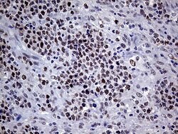 MLH1 Monoclonal Antibody (OTI3C1), TrueMAB , OriGene 100 &mu;L; Unconjugated:Antibodies,
