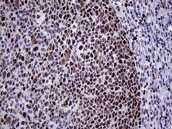 MLH1 Monoclonal Antibody (OTI3C1), TrueMAB , OriGene 100 &mu;L; Unconjugated:Antibodies,