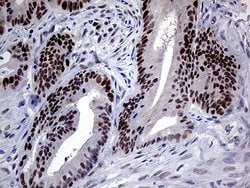 MLH1 Monoclonal Antibody (OTI3C1), TrueMAB , OriGene 100 &mu;L; Unconjugated:Antibodies,