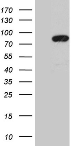 MLH1 Mouse anti-Human, Clone: OTI1B9, lyophilized, TrueMAB 100 &mu;g; Unconjugated:Antibodies,