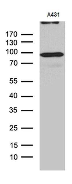 MLH1 Mouse anti-Human, Clone: OTI1B9, lyophilized, TrueMAB 100 &mu;g; Unconjugated:Antibodies,