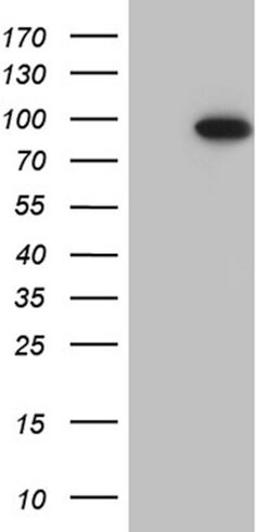 MLH1 Mouse anti-Human, Clone: OTI5F3, lyophilized, TrueMAB 100 &mu;g; Unconjugated:Antibodies,