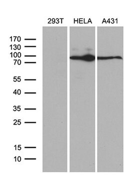 MLH1 Monoclonal Antibody (OTI3C1), TrueMAB , OriGene 100 &mu;L; Unconjugated:Antibodies,