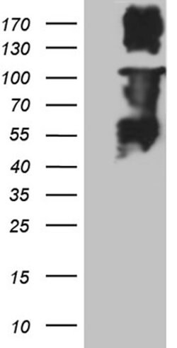 MLH1 Monoclonal Antibody (OTI5H2), TrueMAB , OriGene 100 &mu;L; Unconjugated:Antibodies,