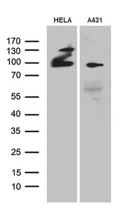 MLH1 Monoclonal Antibody (OTI5H2), TrueMAB , OriGene 100 &mu;L; Unconjugated:Antibodies,