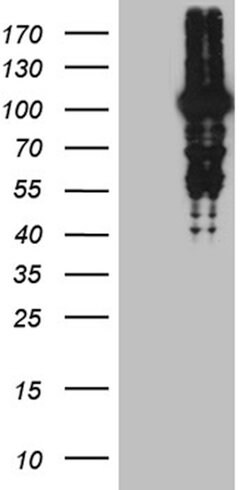 MLH1 Monoclonal Antibody (OTI10F9), TrueMAB , OriGene 100 &mu;L; Unconjugated:Antibodies,