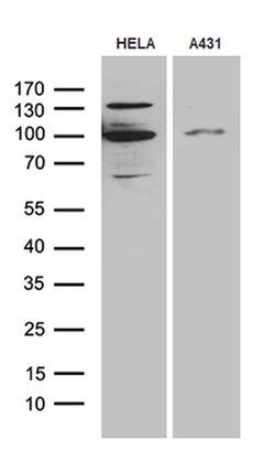MLH1 Monoclonal Antibody (OTI10F9), TrueMAB , OriGene:Antibodies:Primary