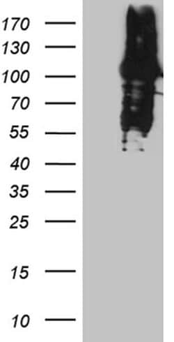 MLH1 Monoclonal Antibody (OTI2A8), TrueMAB , OriGene 100 &mu;L; Unconjugated:Antibodies,