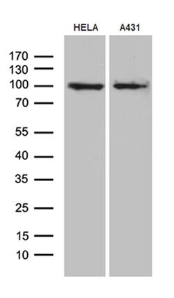 MLH1 Monoclonal Antibody (OTI2A8), TrueMAB , OriGene 100 &mu;L; Unconjugated:Antibodies,